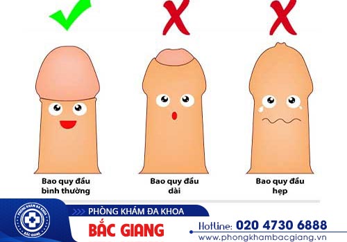 Điểm danh những bệnh nam khoa thường gặp hiện nay