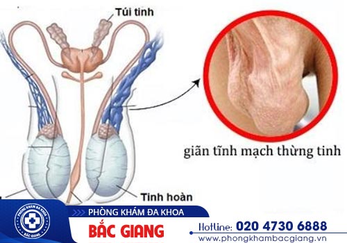 Điểm danh những bệnh nam khoa thường gặp hiện nay