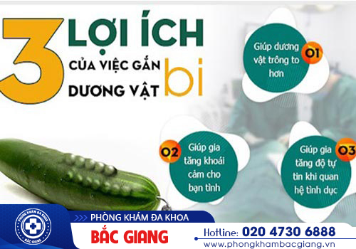 Gắn bi dương vật là gì? Có tốt không?