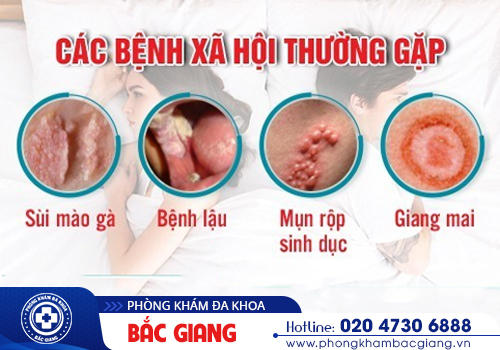 Giá xét nghiệm bệnh xã hội là bao nhiêu? Có đắt không?