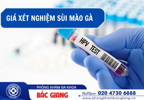 giá xét nghiệm sùi mào gà