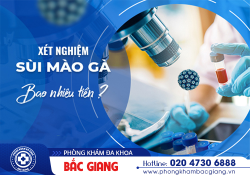 Giá xét nghiệm sùi mào hết bao nhiêu tiền 1 lần?