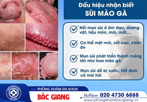 Xét nghiệm máu có phát hiện sùi mào gà không?