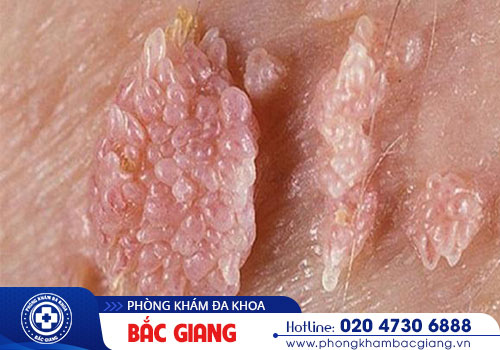 loet-vung-kin-nam-co-nguy-hiem-khong-687