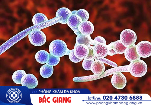 nam-candida-bao-quy-dau-nguyen-nhan-dau-hieu-va-cach-dieu-tri-18