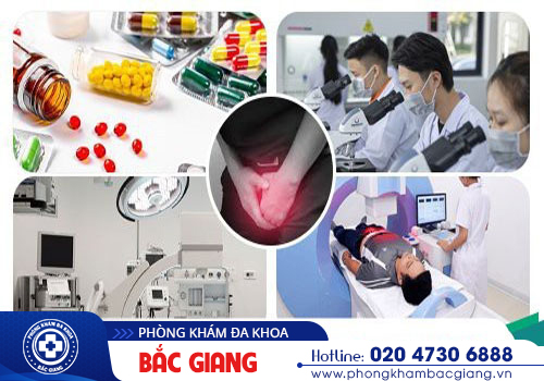 Ngứa bìu tinh hoàn - Những điều nam giới chưa biết