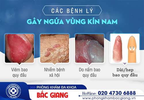 Ngứa rát vùng kín ở nam giới là bệnh gì?