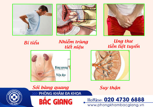 Địa chỉ khám tuyến tiền liệt nam giới uy tín tại Bắc Giang