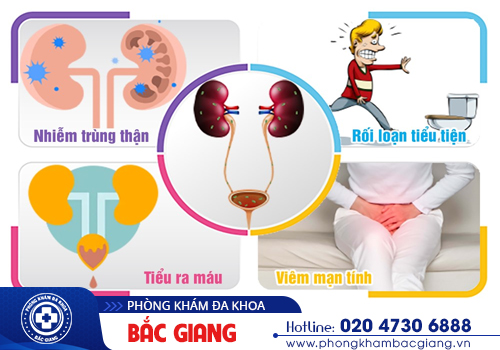 Địa chỉ khám bàng quang cho nam và nữ uy tín tại Bắc Giang