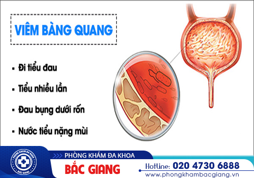 Địa chỉ khám bàng quang cho nam và nữ uy tín tại Bắc Giang