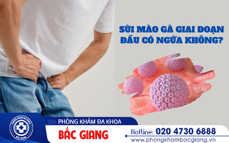 Sùi mào gà giai đoạn đầu có ngứa không?