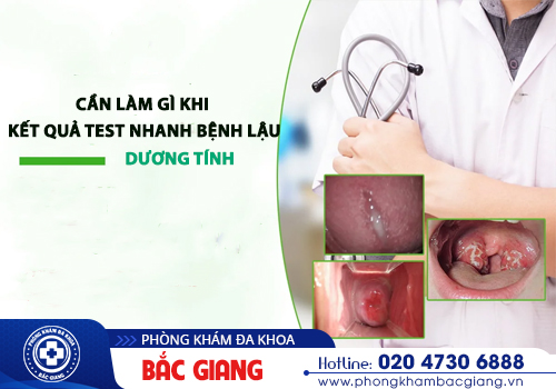 Test nhanh bệnh lậu là gì? Có chính xác không?