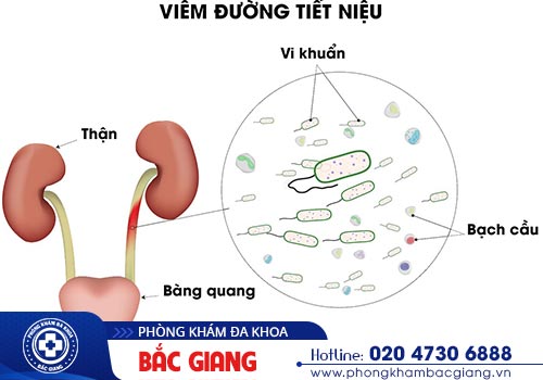 Tiểu đêm nhiều lần nguyên nhân do đâu? Địa chỉ nào khắc phục hiệu quả?