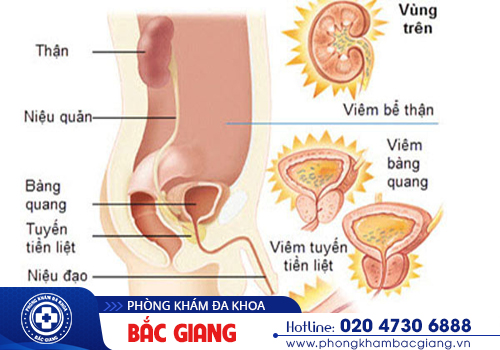 Tiểu không tự chủ - Nguyên nhân và cách điều trị