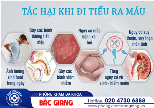 Tiểu Ra Máu Gây Ám Ảnh Với Những Căn Bệnh Nguy Hiểm.