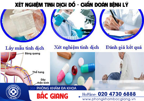 Tinh trùng loãng do đâu? Có ảnh hưởng đến khả năng sinh sản