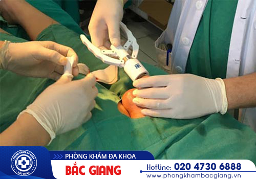 Viêm bao quy đầu mãn tính: Hình ảnh, Nguyên nhân, Cách trị