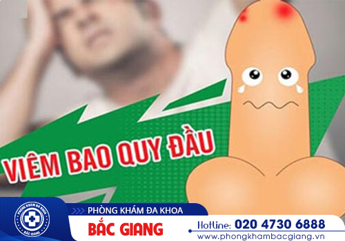 Viêm bao quy đầu mãn tính: Hình ảnh, Nguyên nhân, Cách trị