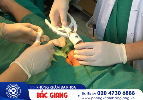 Viêm nấm bao quy đầu là bệnh gì? Dấu hiệu nhận biết bệnh