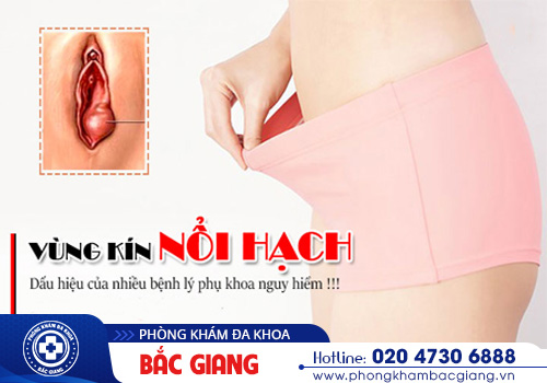Vùng kín nổi hạch là bị làm sao? Có nguy hiểm không?