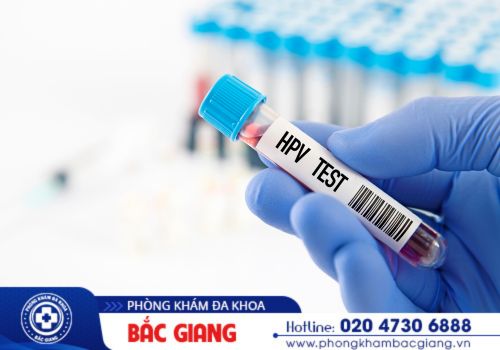 xét nghiệm bệnh hpv