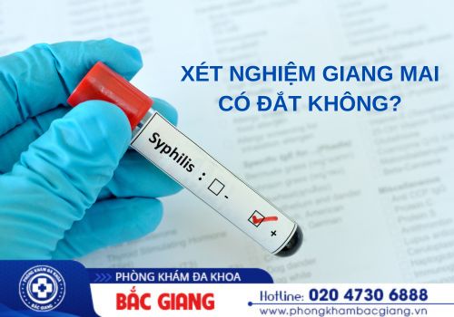 xét nghiệm giang mai có đắt không