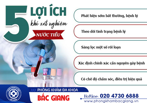 Xét nghiệm nước tiểu - Những thông tin quan trọng mà bạn cần biết