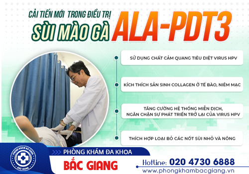 Xét nghiệm sùi mào gà ở nam giới nên thực hiện khi nào?